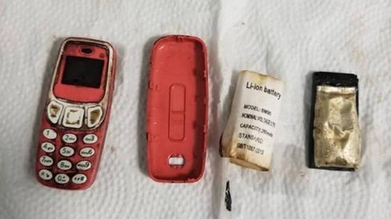 Homem passa por procedimento de emergência após engolir um celular