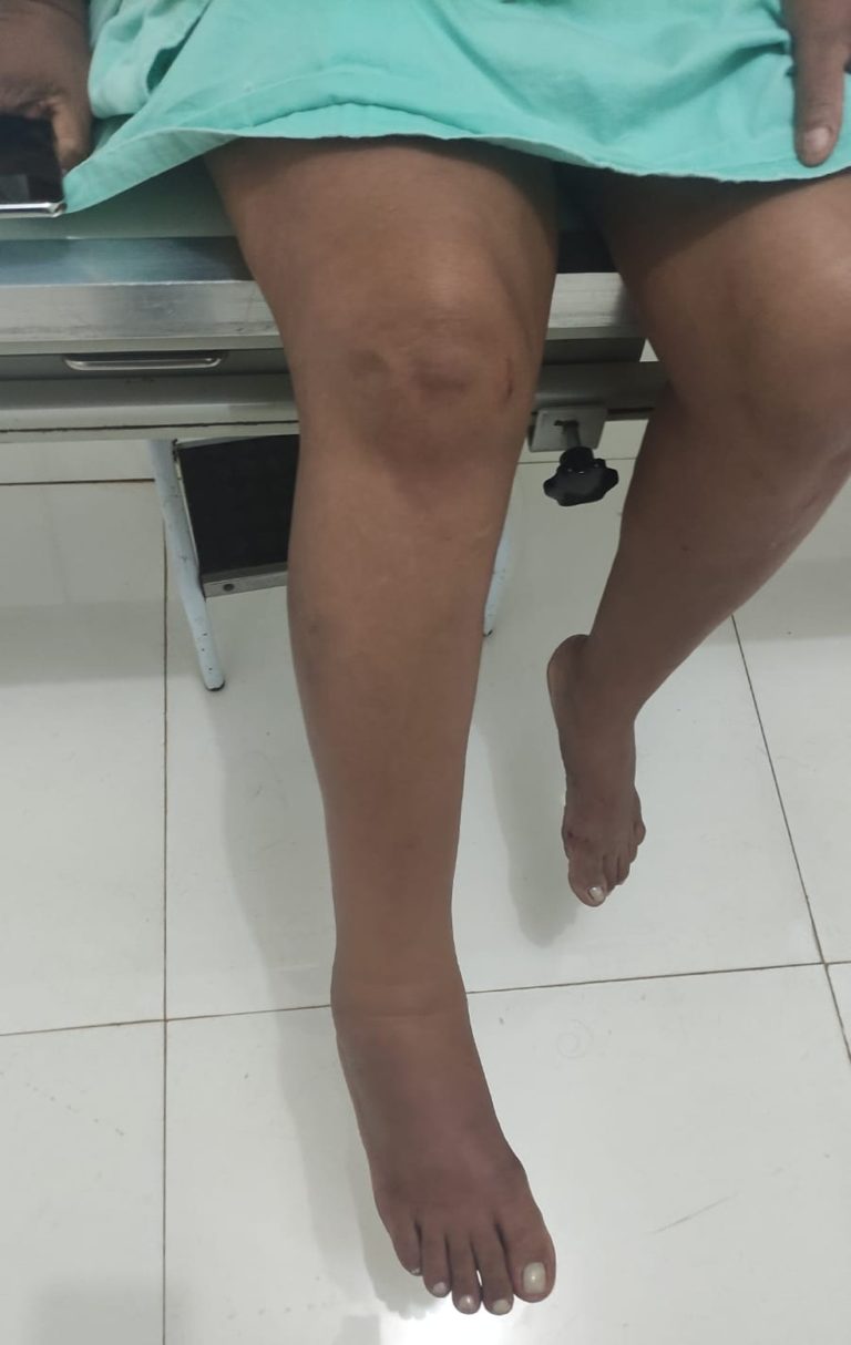 Mulher fica ferida após pular do 1º andar para fugir de agressões do marido