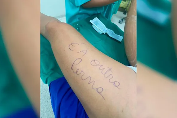 Paciente faz cirurgia e escreve mensagem inusitada em sua perna antes de procedimento