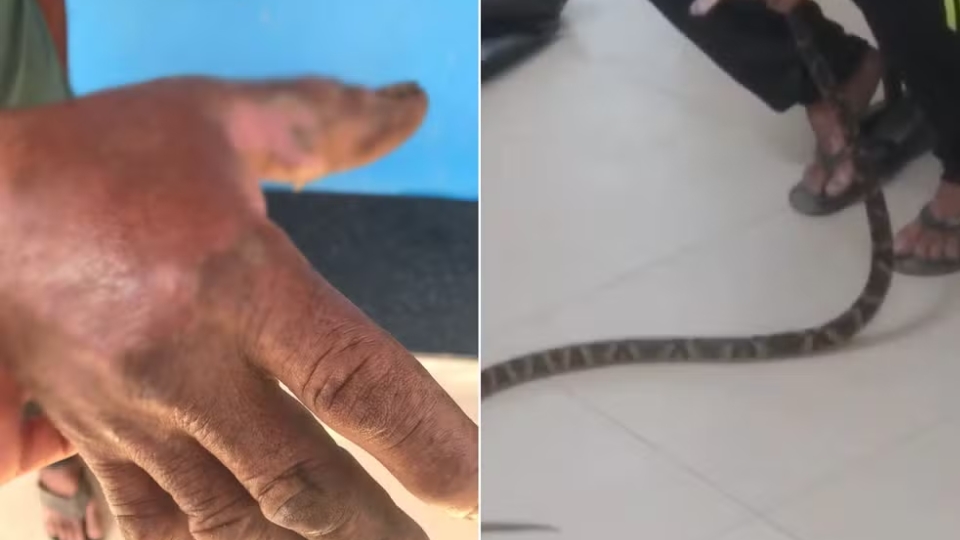 Homem é mordido por jararaca e leva cobra viva a UPA