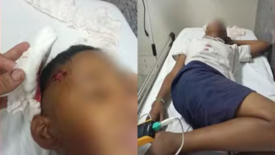 Aluno de 11 anos tem crânio rachado após ser agredido com paulada em escola de MT